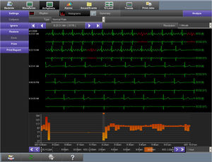 ECG software