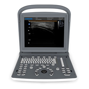 portable ultrasound system