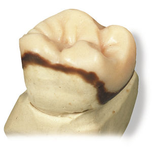 wax dental material