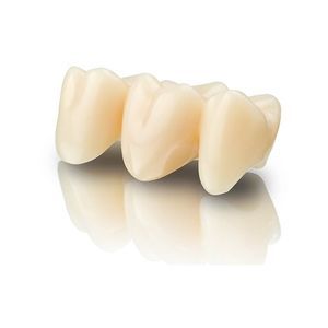 ceramic dental material 1