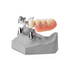 cobalt-chromium dental prosthesis 1
