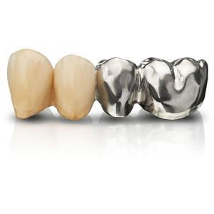 cobalt-chromium dental material 1