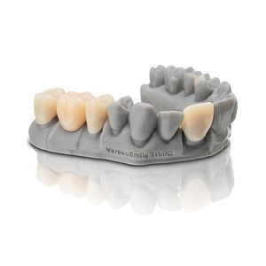 3D printing dental material