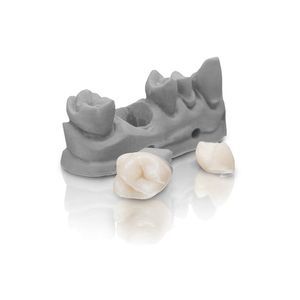 3D printing dental material