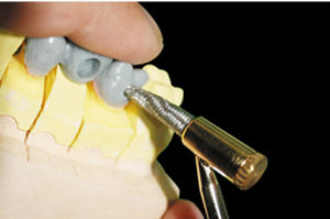 electric dental wax knife