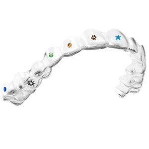 dental aligner 1