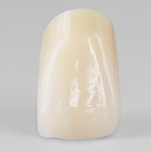 PMMA dental prosthesis