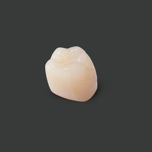 PMMA dental prosthesis