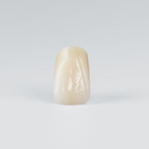 PMMA dental prosthesis 1