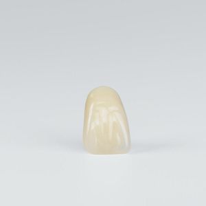 acrylic dental prosthesis 1