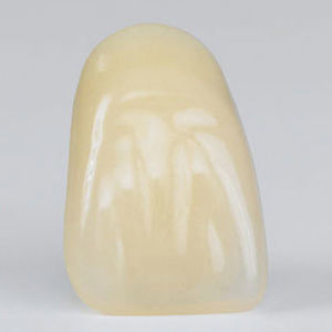 acrylic dental prosthesis
