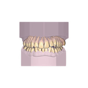 orthodontic software module