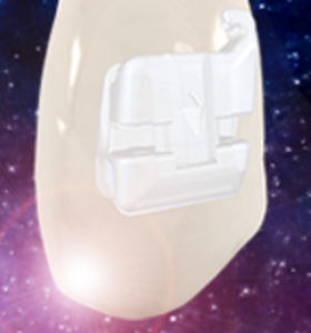 aesthetic orthodontic bracket / self-ligating / ceramic / transparent