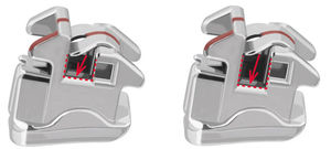 metal orthodontic bracket / self-ligating