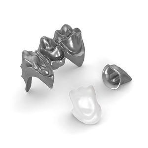 titanium dental prosthesis