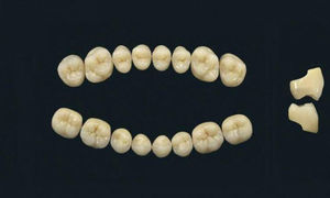 polymer acrylic dental prosthesis 1
