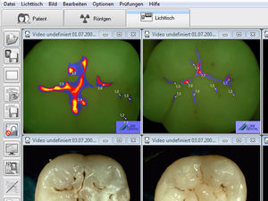 dental imaging software