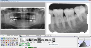 dental imaging software