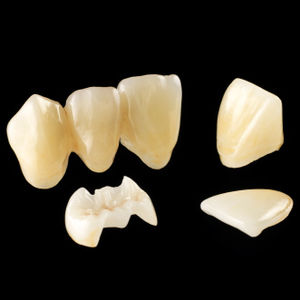glass ceramic dental material