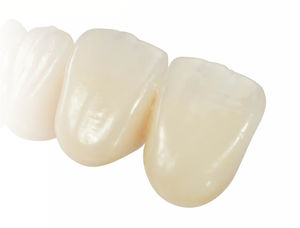 zirconia dental prosthesis