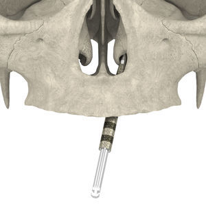 dental implantology drill bit