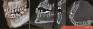 dental imaging software