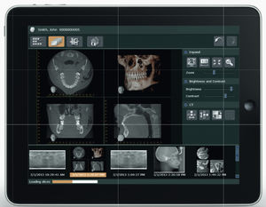 dental imaging software