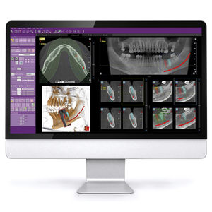 dental imaging software