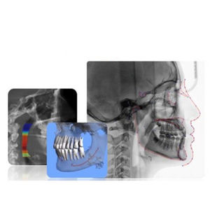 dental imaging software