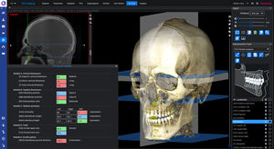 cephalometric analysis software