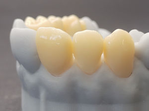 PMMA dental material