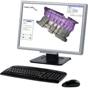 dental CAD/CAM system 1