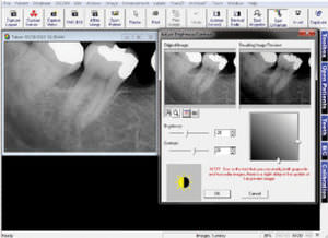 dental imaging software