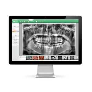 dental imaging software