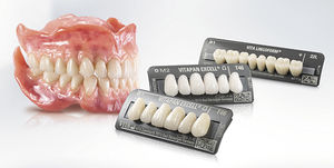 composite dental prosthesis