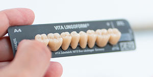 composite dental prosthesis