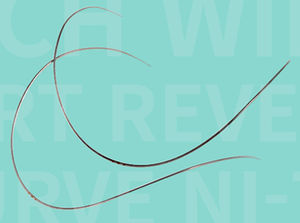 NiTi orthodontic archwire