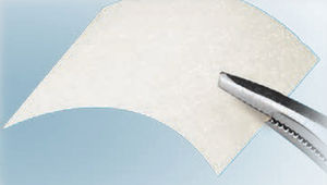 buccal tissue matrix