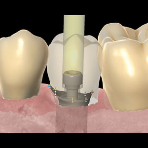 dental laboratory software module