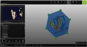 dental laboratory software module