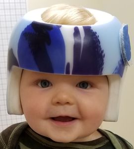 cranial orthosis