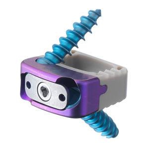 cervical interbody fusion cage