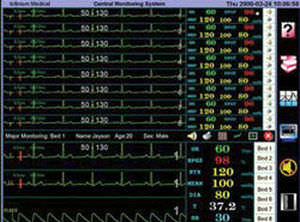 central patient monitoring station