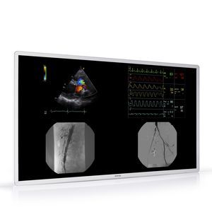 radiology display