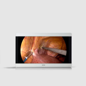 endoscopy display