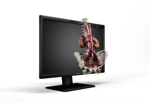 operating room display 1