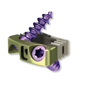 cervical interbody fusion cage