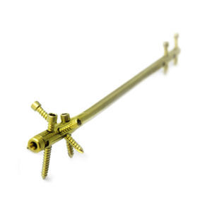 humeral intramedullary nail 1