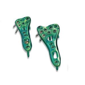 radius compression plate 1