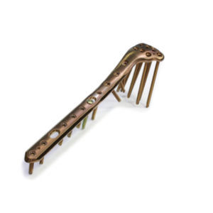 tibia compression plate 1